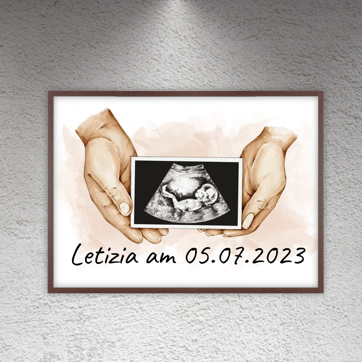 dein Foto Ultraschallbild auf Leinwand - Individuelle Leinwand | Personalize Palace